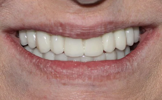 sourire-nadine-s-apres.jpg