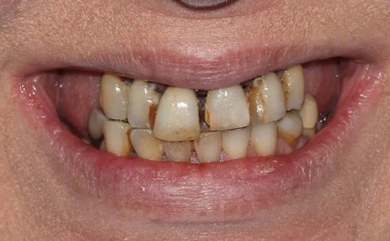 sourire-nadine-s-avant.jpg