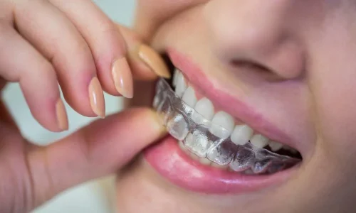 Orthodontiste.jpg